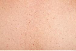 Photo Textures of Human Skin